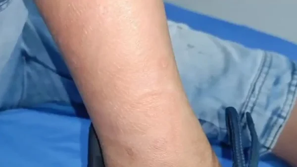 Nuevos hallazgos: el hermano del niño de 10 años también era encadenado en Soledad, Atlántico