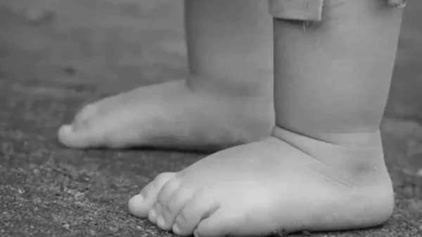 Niña de 5 años era maltratada por su propia mamá: tenía quemaduras en sus partes íntimas