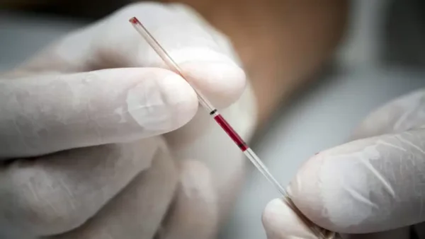 ¿Qué es la sífilis y por qué es crucial detectarla temprano?