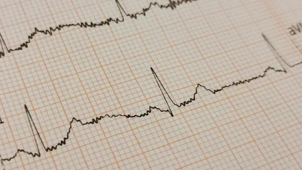 🔴EN VIVO🔴 Fuerte Temblor en Colombia: Se registró un movimiento de 3.6 el 18 de mayo de 2024