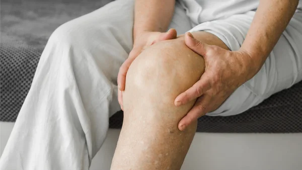 ¿Por qué sube el ácido úrico? Conozca las razones y cómo mantenerlo bajo control