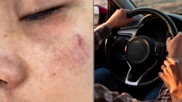 Mujer fue agredida de manera brutal por conductor en Medellín tras regar una bebida en su carro