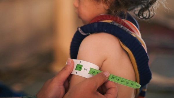 Crisis en la comunidad Yukpa: ya van nueve niños indígenas muertos por desnutrición en resguardo del Cesar