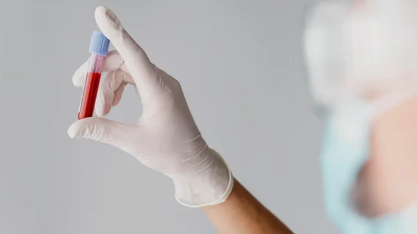 ¿Quiere donar sangre? Estos son los puntos a los que puede acercarse en Bogotá