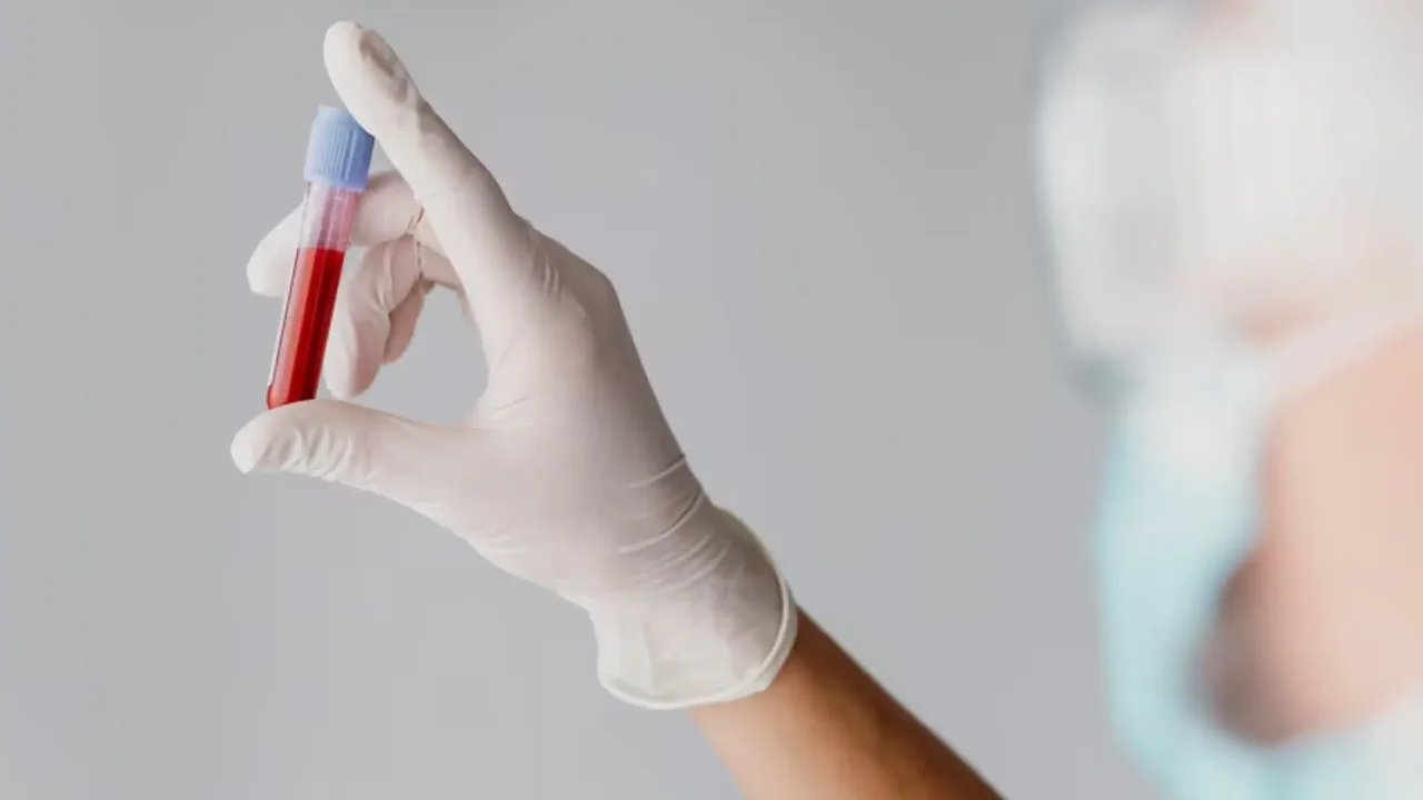 Research bets on new blood tests to detect Alzheimer's