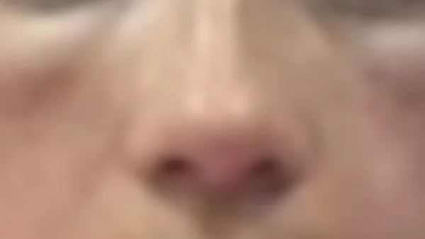 “Tengo bultos y me arde la vista”: mujeres denuncian haber sido estafadas por falsas esteticistas “Tengo bultos y me arde la vista”: mujeres denuncian haber sido estafadas por falsas esteticistas