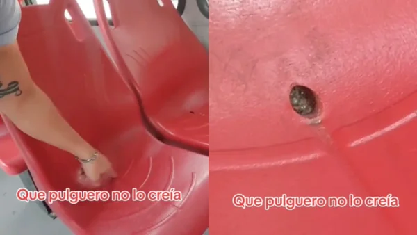 Conductor de SITP expuso nido de pulgas y garrapatas en una silla: conmoción en las redes Conductor de SITP expuso nido de pulgas y garrapatas en una silla: conmoción en las redes