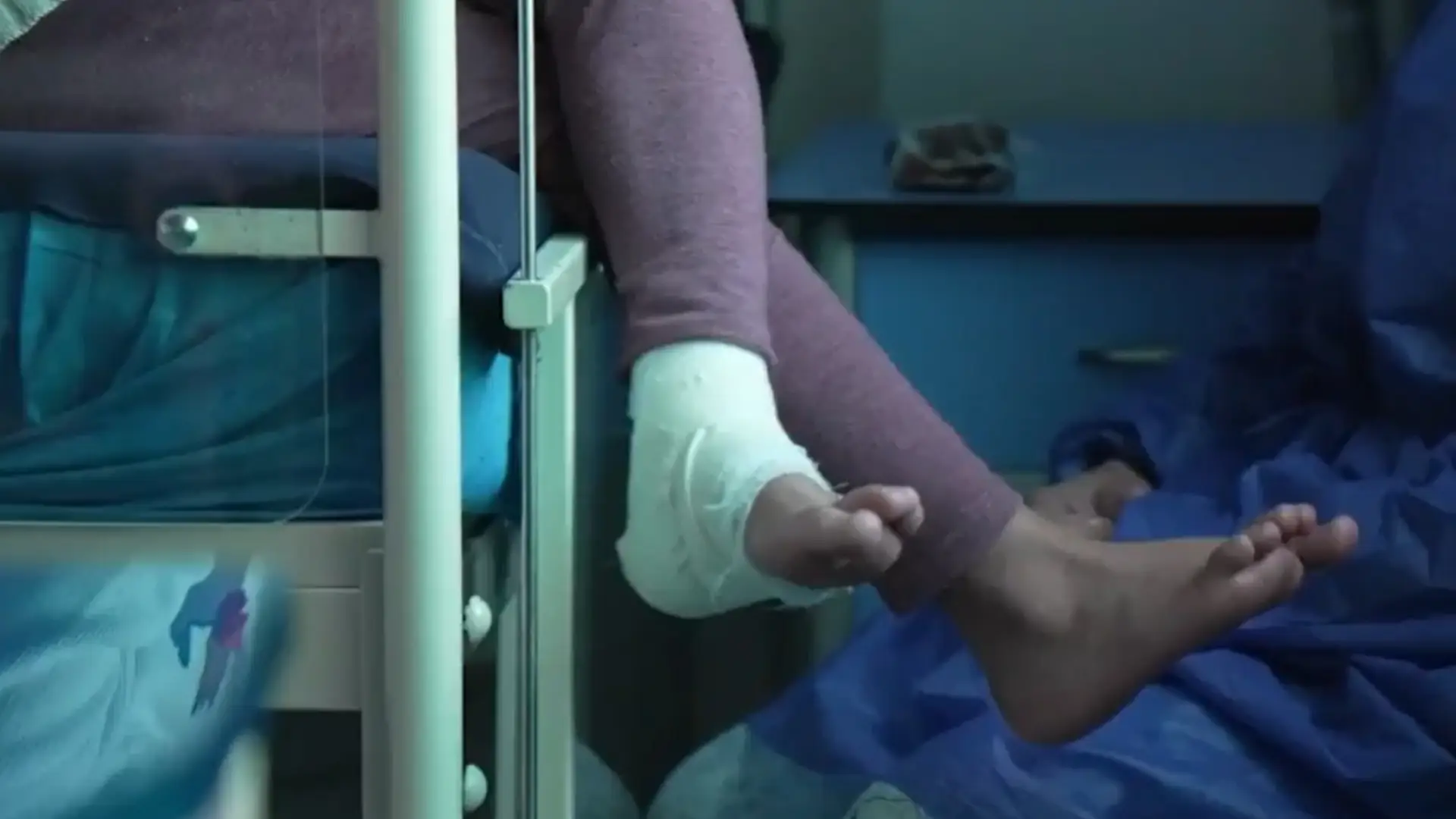 quemados por polvora