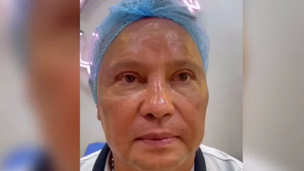 ¡Irreconocible! Así quedó Giovanny Ayala tras una cirugía estética en el rostro