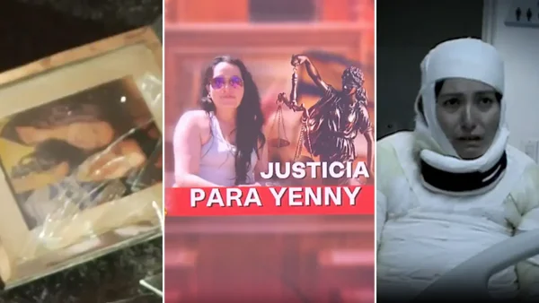 Su expareja la habría quemado: tras semanas hospitalizada falleció y meses después la justicia no ha llegado Su expareja la habría quemado: tras semanas hospitalizada falleció y meses después la justicia no ha llegado