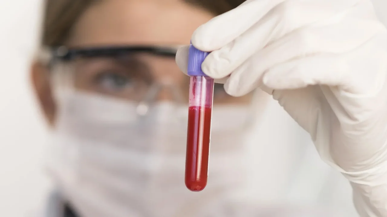 En Colombia más de mil pacientes requieren transfusiones de sangre en un día