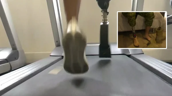 Impresionante transformación de infante de marina que perdió una pierna por mina antipersonal Impresionante transformación de infante de marina que perdió una pierna por mina antipersonal