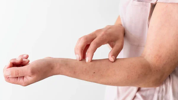 La piel puede revelar los primeros signos de diabetes: conozca qué síntomas observar La piel puede revelar los primeros signos de diabetes: conozca qué síntomas observar