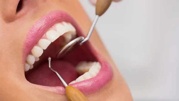 Dentista revela algunos hábitos que podrían afectar la salud de los dientes