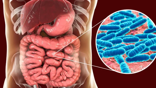 Microbios orales e intestinales son asociados con el desarrollo del Parkinson