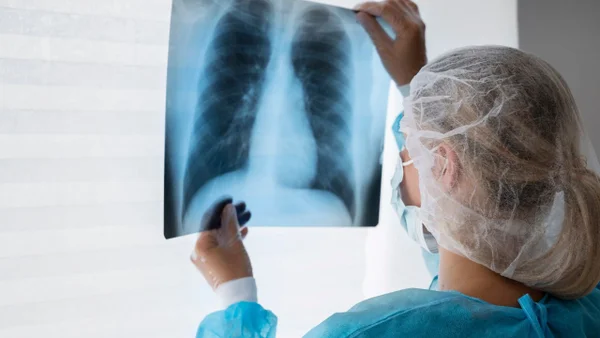 Contaminación atmosférica y cáncer de pulmón: estudio explica el fenómeno