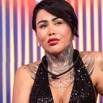 Yina Calderón se hizo un inesperado procedimiento en su rostro y así