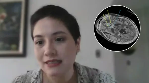 Innovadora cirugía que ayudaría a combatir la depresión fue practicada por primera vez en Santander