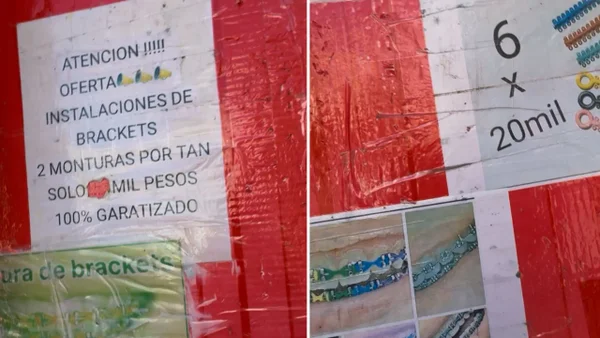 Punto final para consultorios de odontología callejeros que operaban en Bogotá Punto final para consultorios de odontología callejeros que operaban en Bogotá