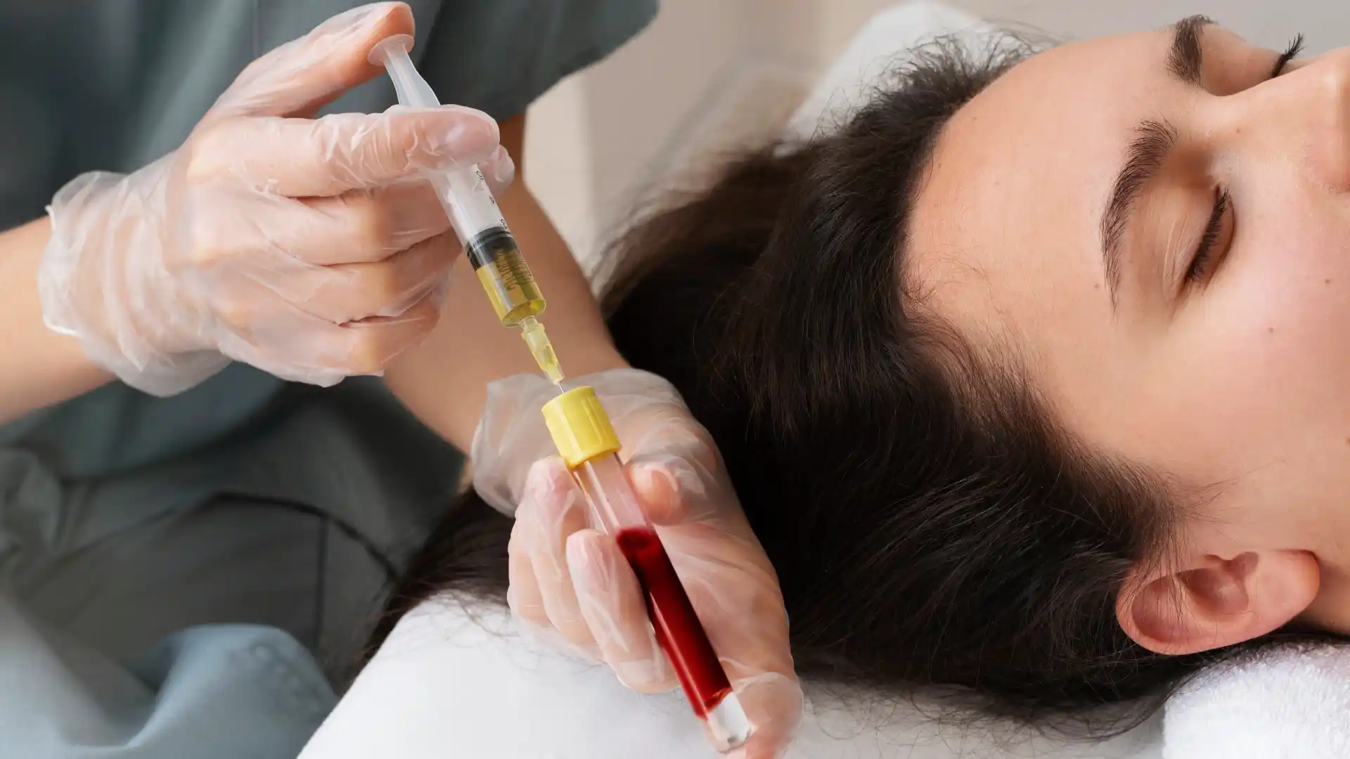 Lo que hay detrás del plasma rico en plaquetas: mitos y verdades