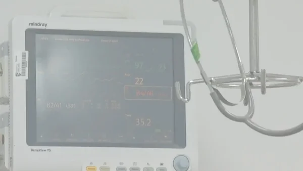 Instalan equipo de última tecnología para niños con fallas renales en Popayán: ¿de qué se trata?