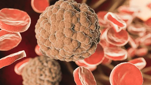 ¿Qué es el mieloma múltiple, uno de los cánceres de sangre más comunes? ¿Qué es el mieloma múltiple, uno de los cánceres de sangre más comunes?