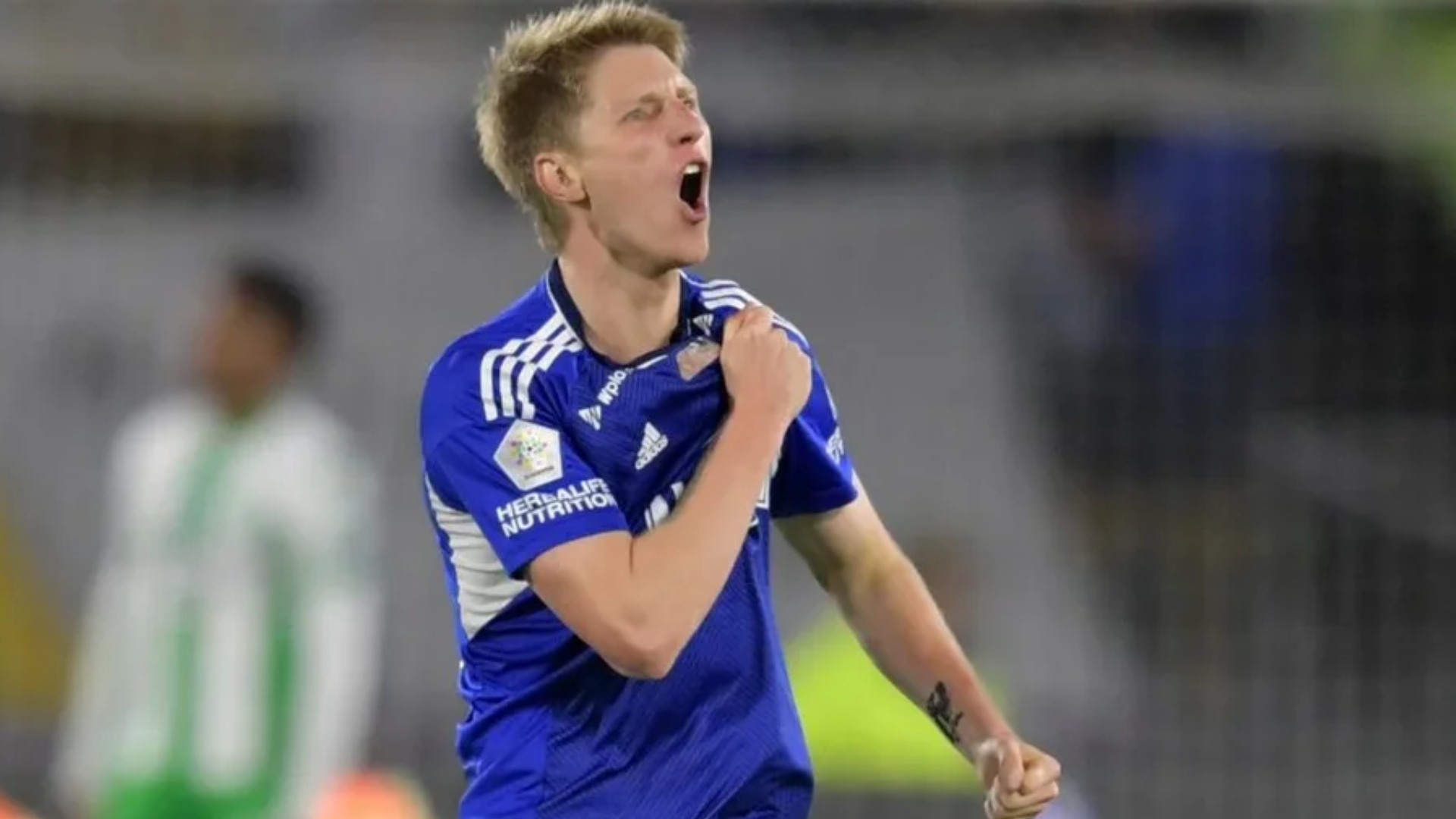 Andrés Llinás operado con éxito y con camiseta de Millonarios