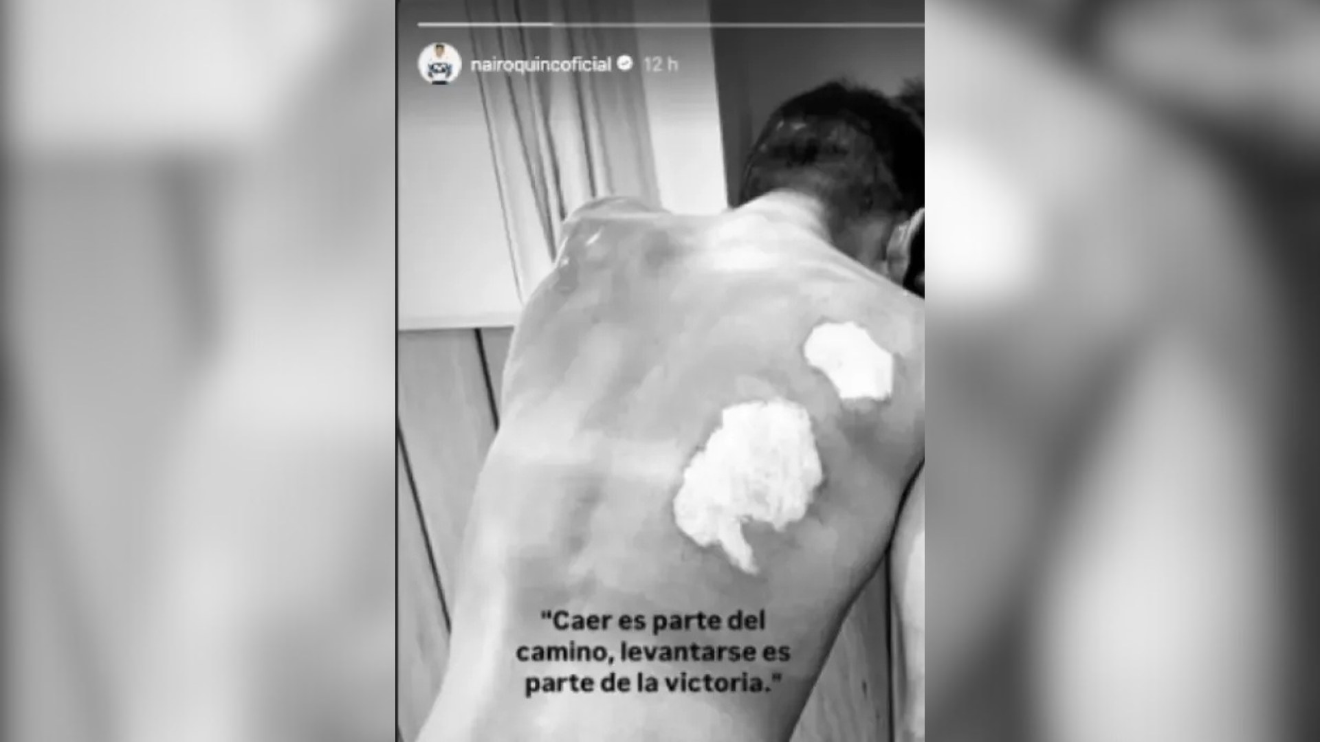 Nairo Quintana-heridas