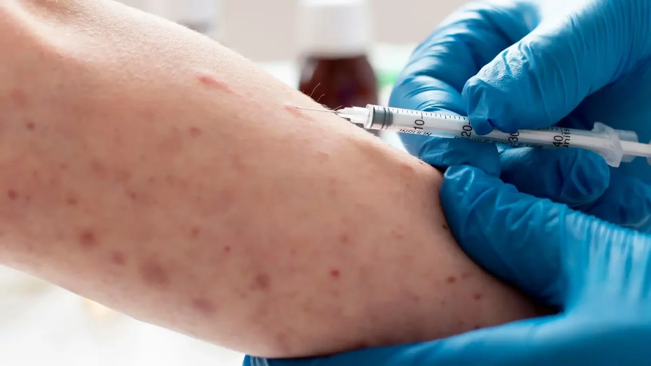 Health Ministry Denies Confirmation, Maintains Suspicious Measles Case in Bogotá Under Study