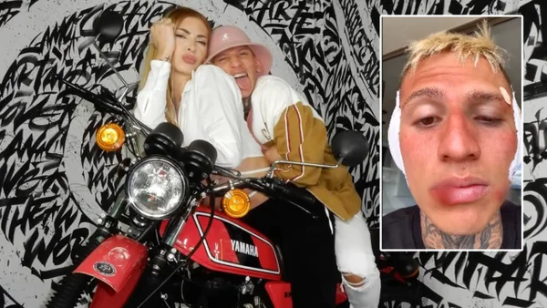 ¿Qué hay detrás de las cicatrices con las que apareció La Liendra? Dani Duke habría contado la verdad