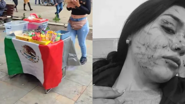 Transmisión en vivo terminó mal: emprendedora fue desfigurada por otra mujer en el centro de Bogotá Transmisión en vivo terminó mal: emprendedora fue desfigurada por otra mujer en el centro de Bogotá