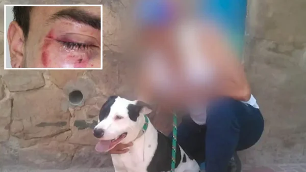 Cliente fue brutalmente golpeado por un repartidor tras no darle propina: lo sigue amenazando Cliente fue brutalmente golpeado por un repartidor tras no darle propina: lo sigue amenazando