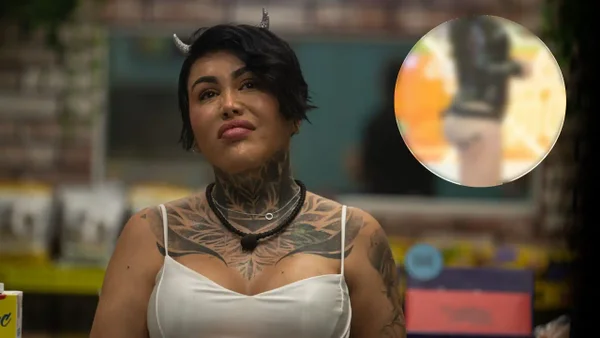 Yina Calderón reveló la cantidad de cirugías a las que se ha sometido para reconstruir sus glúteos