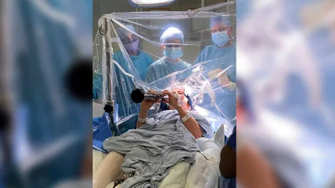 Paciente con Parkinson tocó el clarinete durante cirugía.