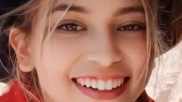 Joven de 15 años fue quemada por cuatro adolescentes: su familia pide ayuda y justicia Joven de 15 años fue quemada por cuatro adolescentes: su familia pide ayuda y justicia