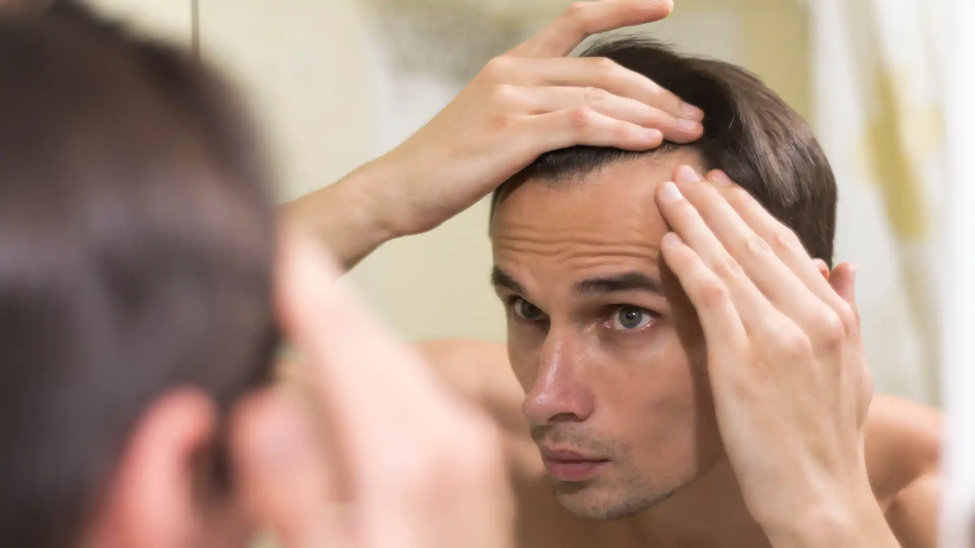 Alopecia en hombres