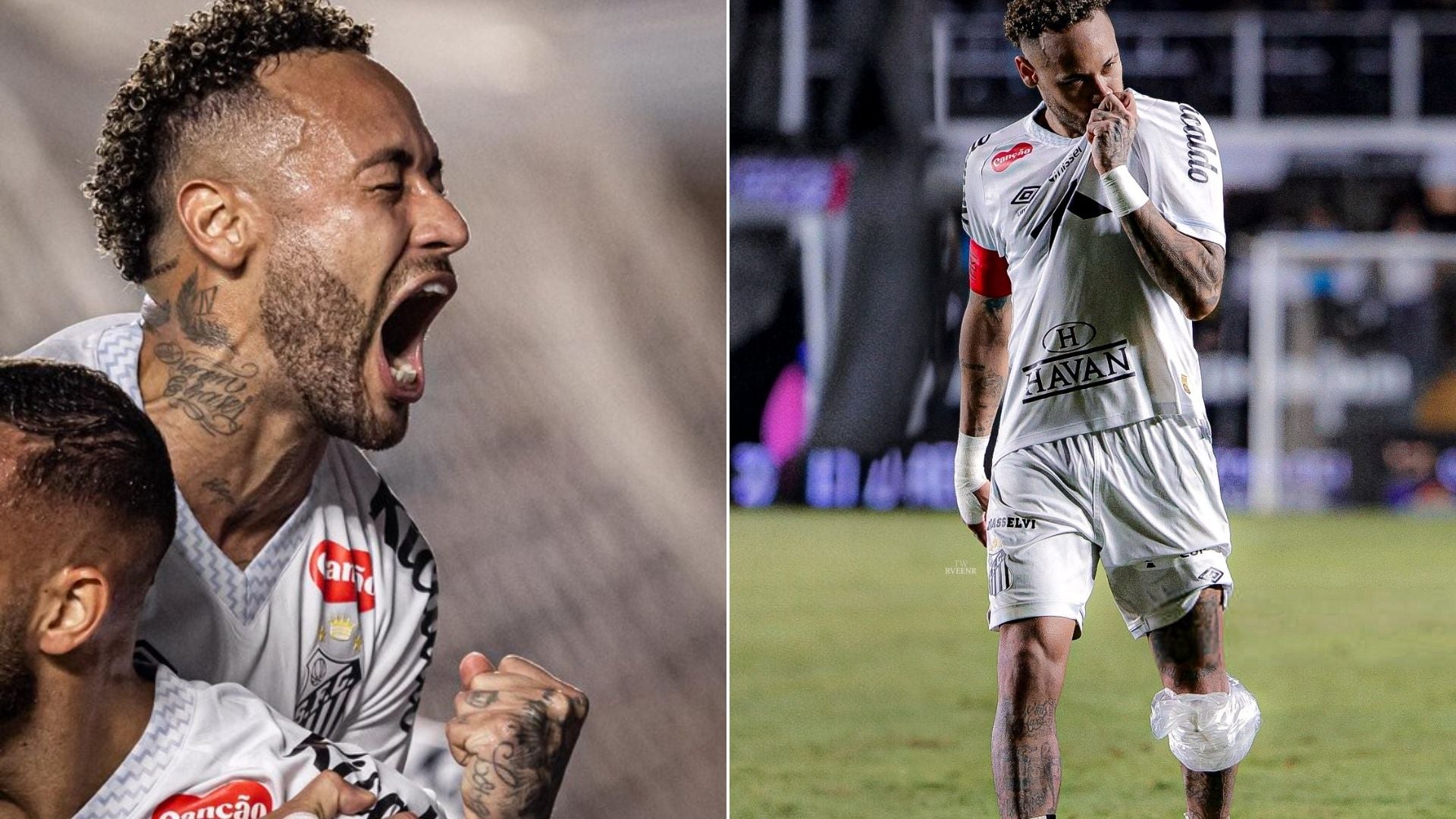 Neymar jugó lesionado con Santos