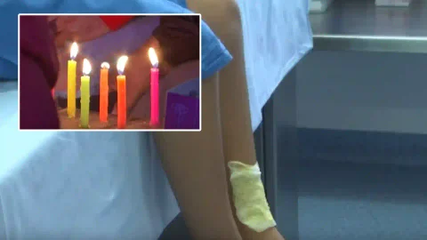 ¿Qué debe hacer en caso de sufrir una quemadura con velas, pólvora o líquidos calientes?