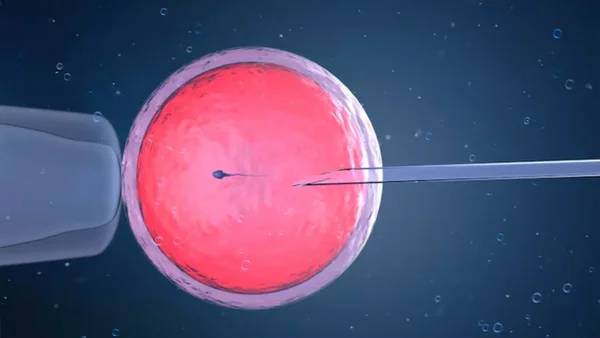 ¿Cómo es que la Inteligencia artificial podría mejorar los procedimientos de reproducción asistida?