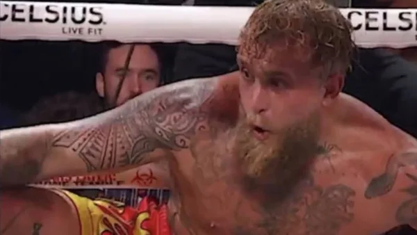El terrible golpe que sufrió Jake Paul y que lo mandó directo al quirófano