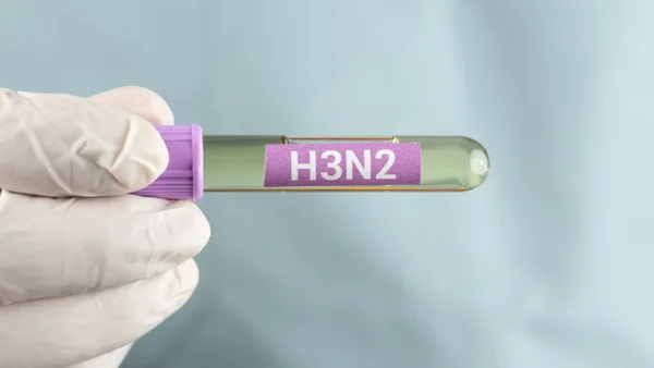 ¿Cuáles son los síntomas de la influenza A (H3N2)?