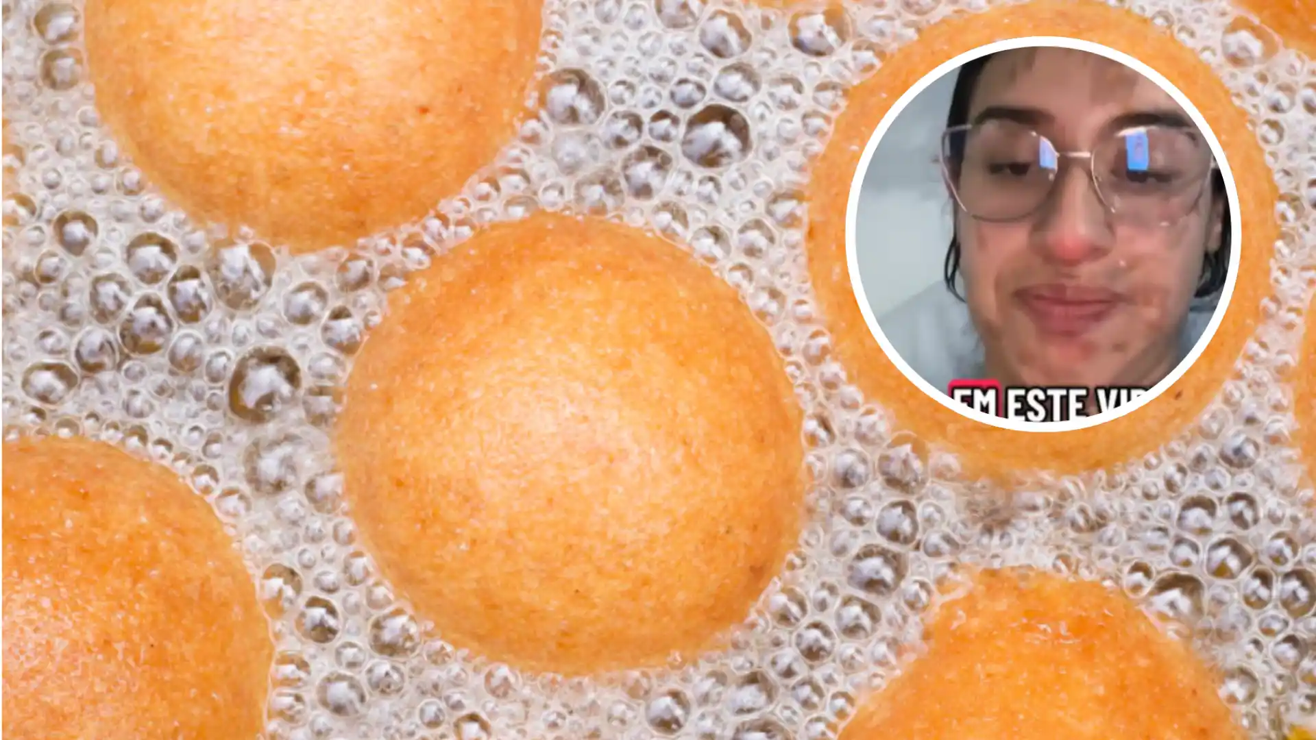 Mujer quemada por hacer buñuelos.