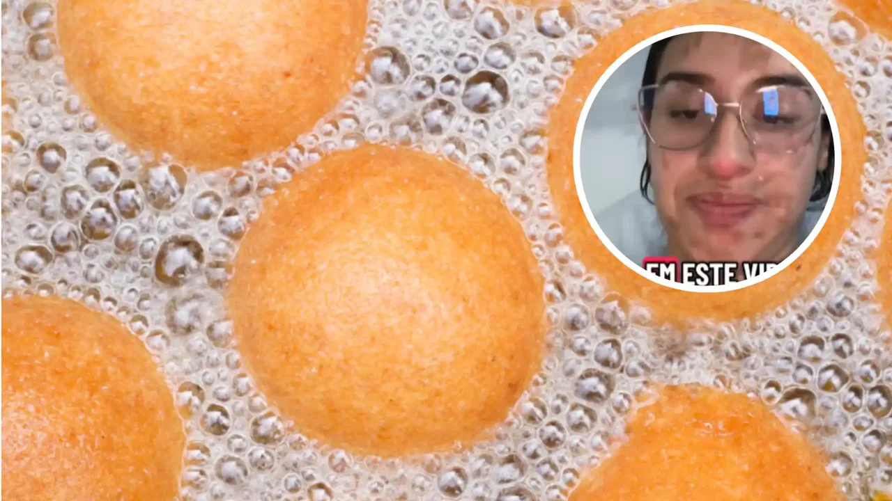 “Son una bomba”: buñuelos causan quemaduras de segundo grado en jóvenes de Bogotá