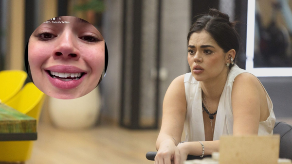 La Segura perdió la mitad de su diente y así reaccionó en sus redes sociales