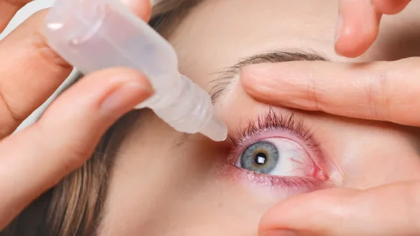 Alerta por producto fraudulento para los ojos en el país: Invima advirtió