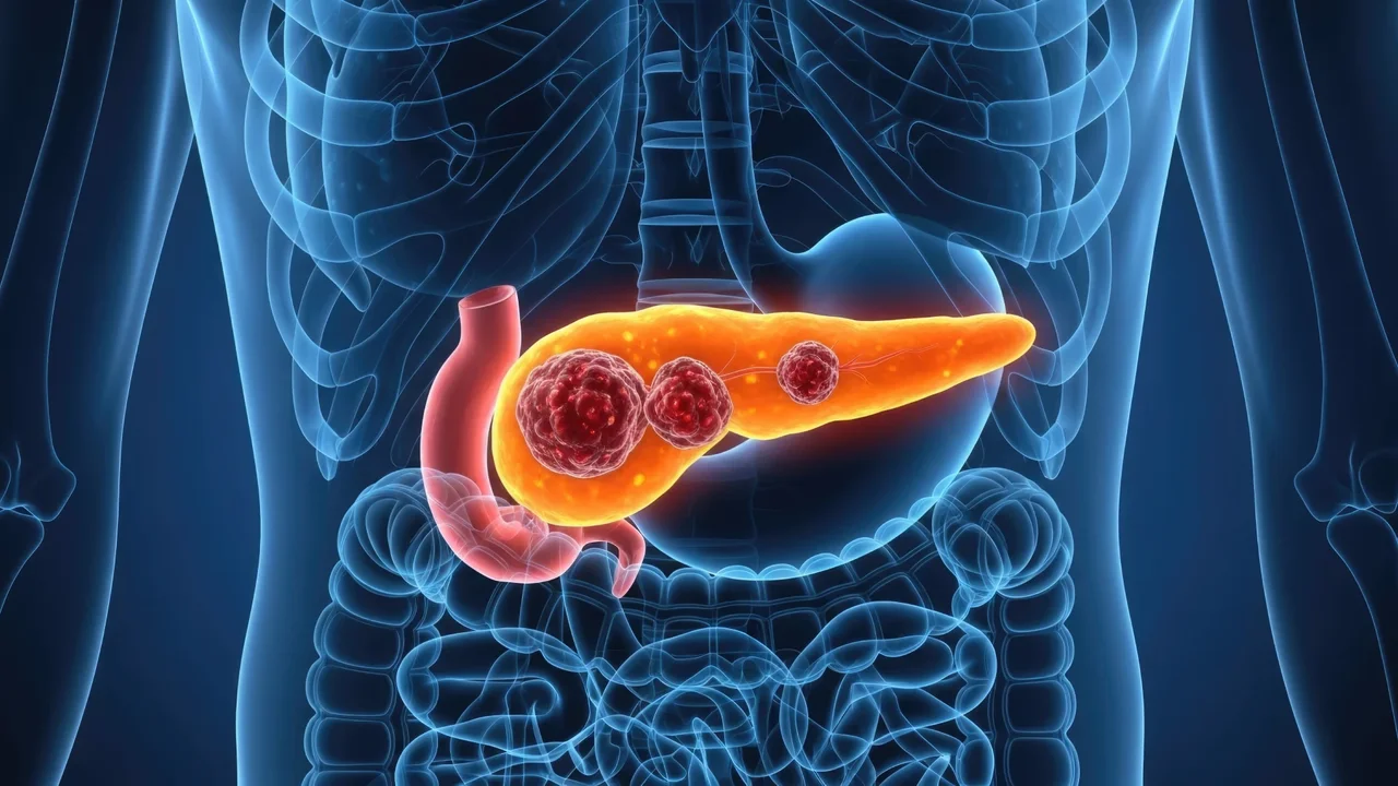 Expertos consiguen un avance histórico con el que se acercan a la cura del cáncer de páncreas