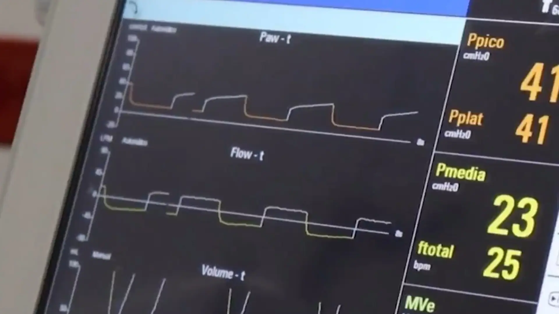 Niño con hemofilia en riesgo por medicamentos