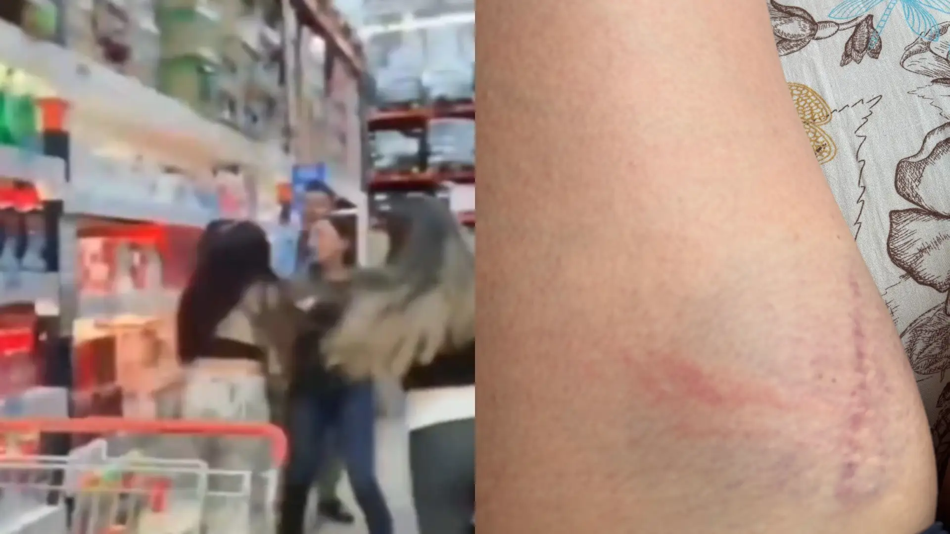 Agresión a mujer en Bogotá