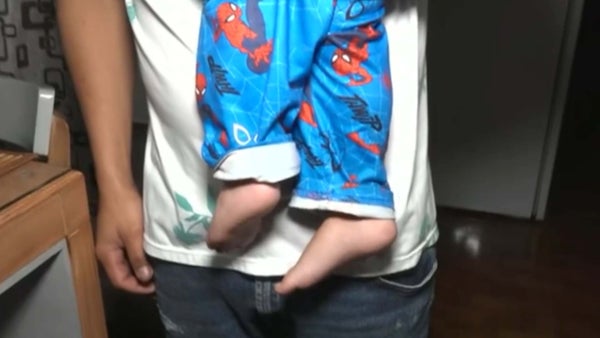 Eithan Sebastián, primito de Kevin, también padece hemofilia y lleva dos meses sin recibir medicamentos