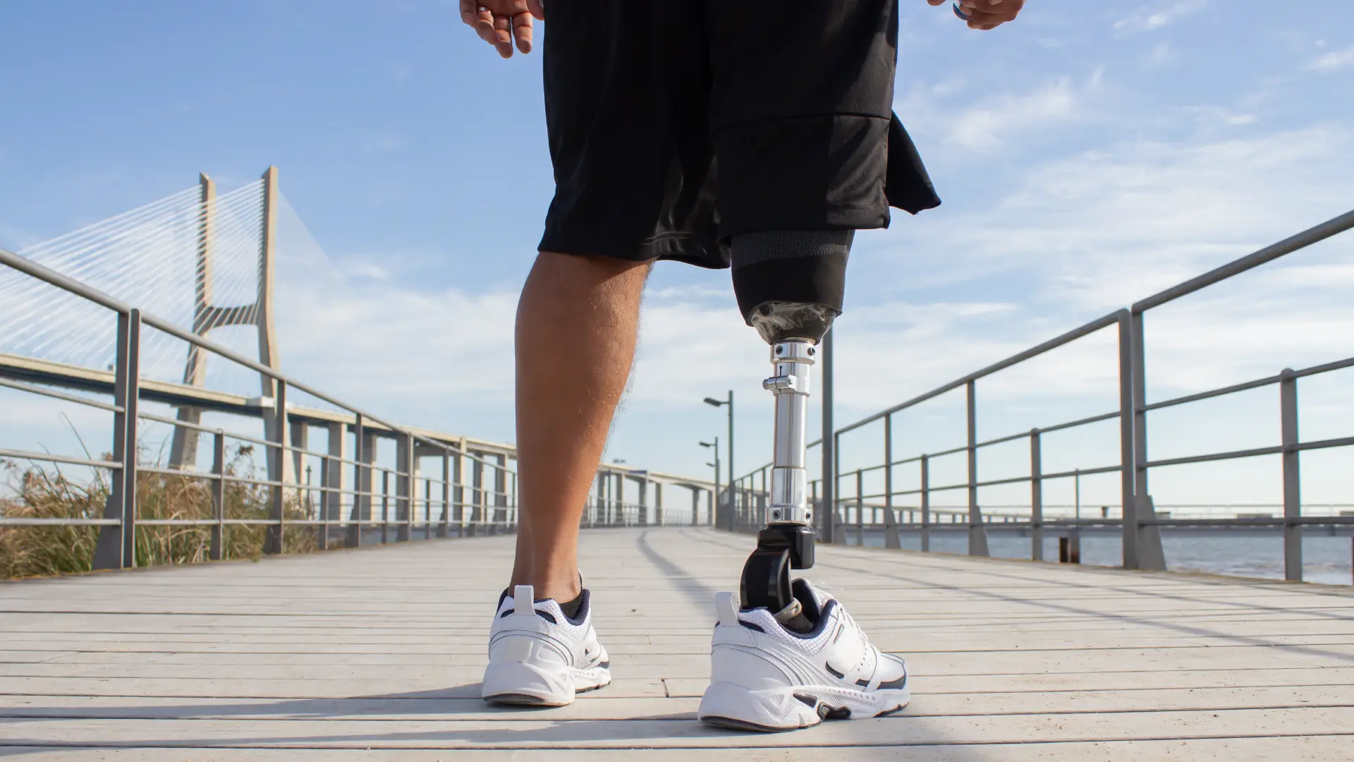 Rodillas mecatrónicas y prótesis inteligentes revolucionan la rehabilitación en Colombia